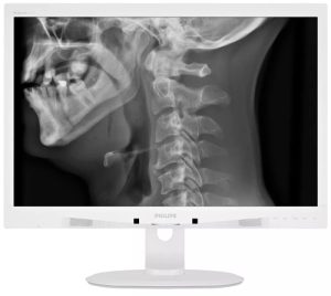 Philips LCD monitor with Clinical D-image C240P4QPYEW/00