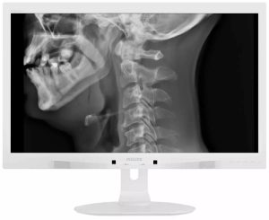 Philips LCD monitor with Clinical D-image C271P4QPJEW/00