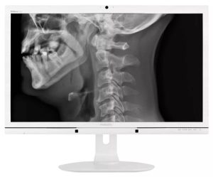 Philips LCD monitor with Clinical D-image C272P4QPKEW/00