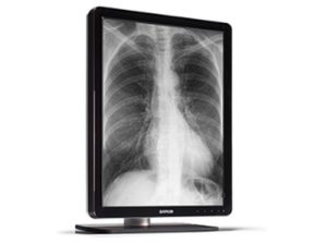 Barco Coronis 3MP LED