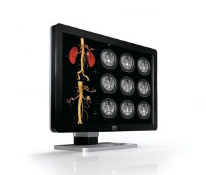 Barco Coronis Fusion 4MP (MDCC-4330)