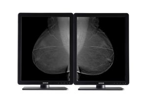 Barco Nio 5MP LED (MDNG-5221)