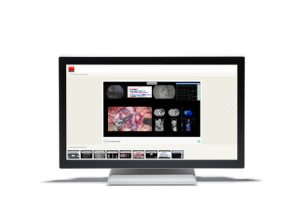Barco 215ETTWZE
