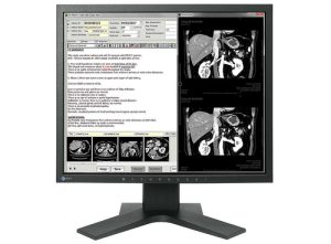 EIZO MX194