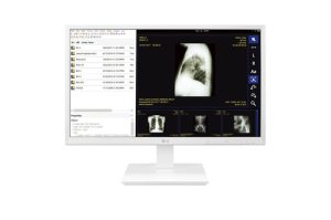 LG 24CK560N-3A
